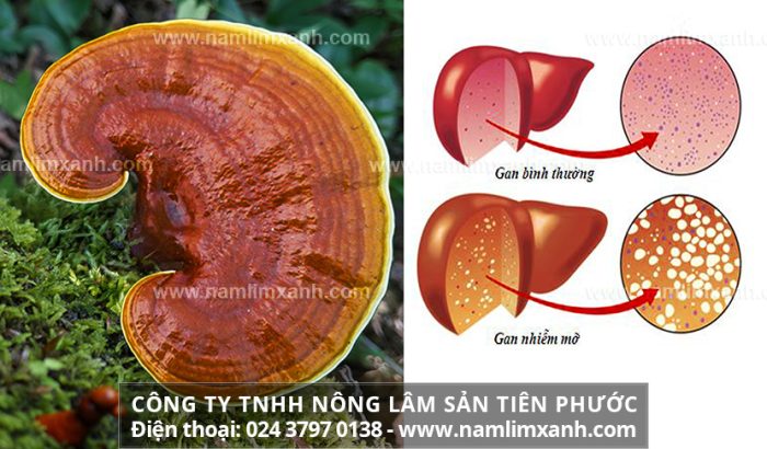 Nấm lim xanh chữa bệnh gan nhiễm mỡ hiệu quả với đặc điểm nấm lim Lào