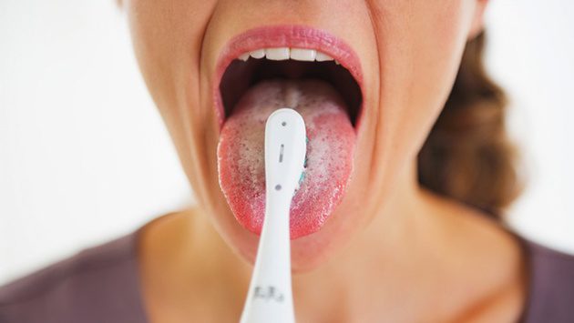 Lưỡi xuất hiện màu trắng là dấu hiệu cơ thể chứa độc tố