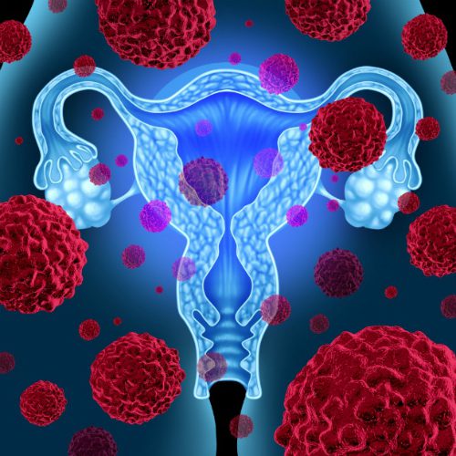 Virus HPV gây ung thư tử cung chủ yếu lây qua đường tình dục