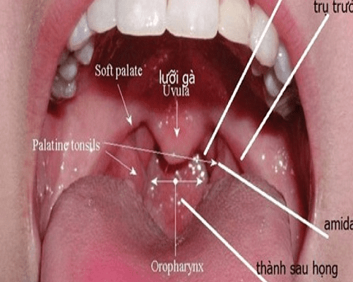 7 nguyên nhân gây ung thư vòm họng gồm những gì?