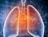 Cách điều trị bệnh ung thư phổi và những vấn đề cơ bản xung quanh