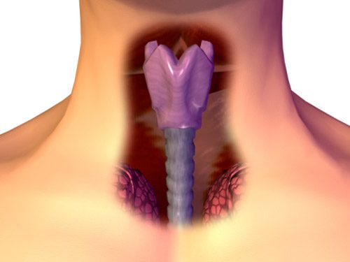 Biểu hiện của ung thư vòm họng giai đoạn 3