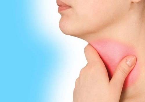 Ung thư vòm họng giai đoạn 4 nguy hiểm nhất trong các giai đoạn ung thư vòm họng