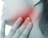 Ung thư vòm họng triệu chứng là gì? Nguyên nhân và cách điều trị