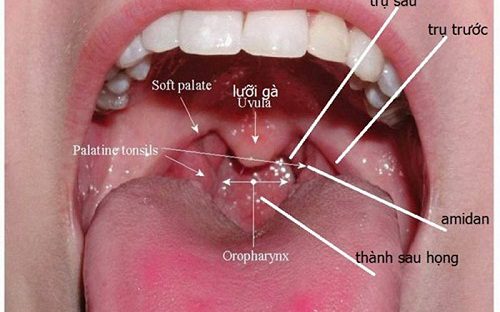 Hình ảnh của ung thư vòm họng giai đoạn đầu