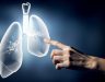 Nguyên nhân dẫn đến ung thư phổi là gì? Cách điều trị và phòng tránh
