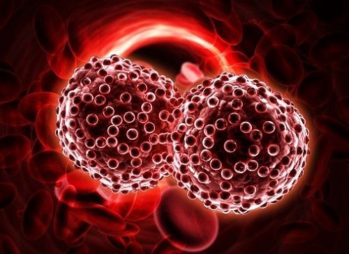 Nguyên nhân gây ung thư máu là do bạch cầu nhiều hơn hồng cầu.