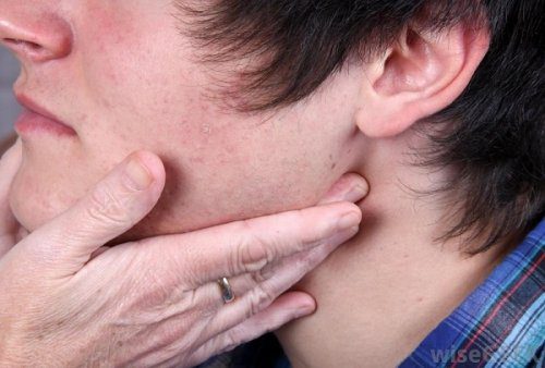 Nổi hạch phía hàm là một trong những dấu hiệu ung thư vòm họng giai đoạn đầu