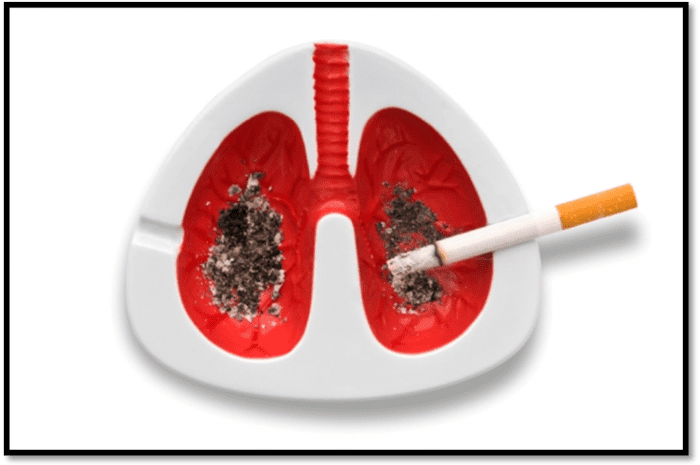 Thuốc lá là nguyên nhân chính gây ung thư phổi