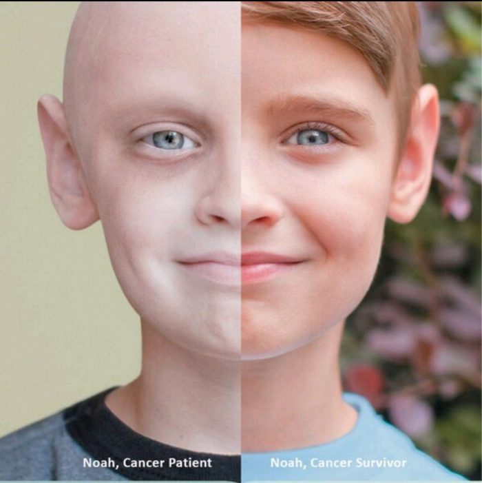 Bệnh ung thư ở trẻ em          