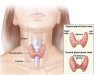 Ung thư vòm họng sống được bao lâu ở các giai đoạn theo Bác sĩ chuyên khoa