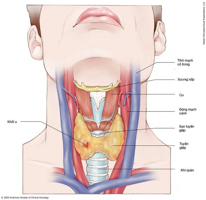 Ung thư vòm họng có lây không là vấn đề nhiều độc giả quan tâm. Tỉ lệ mắc ung thư vòm họng của nam giới cao hơn nữ giới