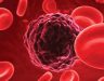 Điều trị ung thư máu bằng tế bào gốc và những điều bạn chưa biết