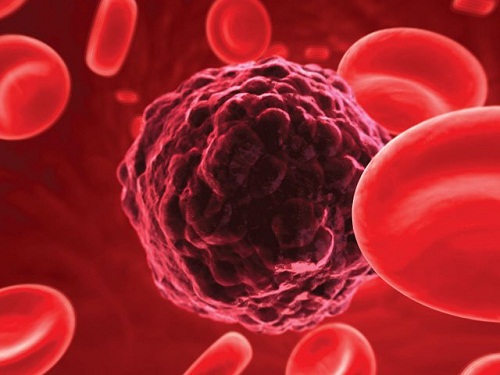 Điều trị ung thư máu bằng tế bào gốc
