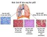 Hình ảnh những người bị ung thư phổi. Nguyên nhân ung thư phổi