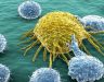 Thức ăn cho tế bào ung thư là gì? Cách bỏ đói tế bào ung thư