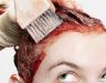 Biểu hiện ung thư da đầu là gì? Mức độ nguy hiểm của bệnh