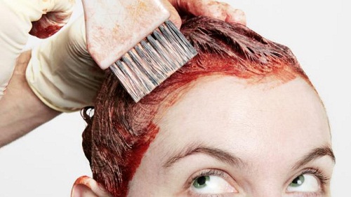 Thuốc nhuộm tóc là một trong những nguyên nhân dẫn đến các biểu hiện ung thư da đầu