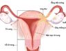 Các dấu hiệu của bệnh ung thư tử cung. Cách điều trị ung thư tử cung