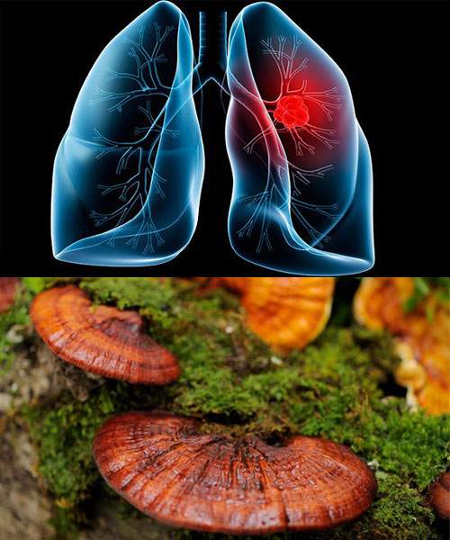 Nấm lim xanh là cây thuốc Nam trị ung thư phổi mang lại hiệu quả tốt