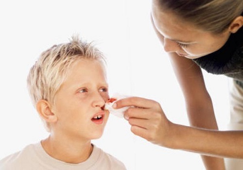 Chảy máu mũi là dấu hiệu bệnh ung thư máu ở trẻ nhỏ