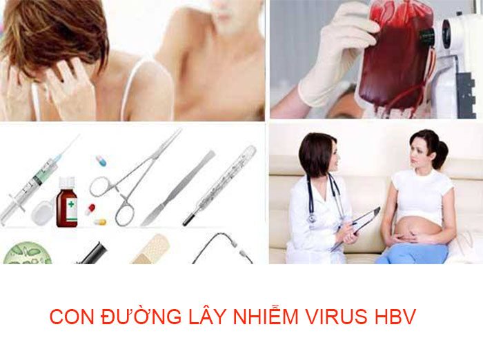Con đường lây nhiễm của viêm gan B cũng giống như HIV