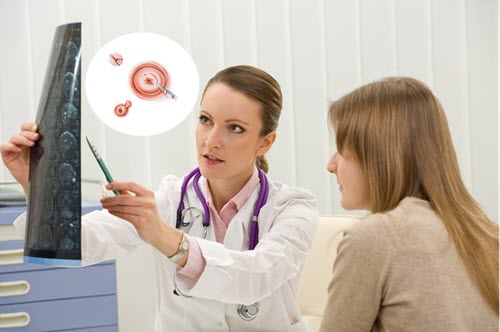 Thăm khám bác sĩ ngay khi có dấu hiệu ung thư cổ tử cung