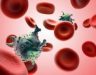 Ghép tế bào gốc ung thư máu là gì? Ung thư máu chữa được không?