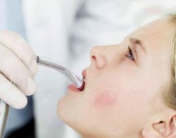 Đi khám răng miệng thường xuyên để phát hiện ung thư khoang miệng