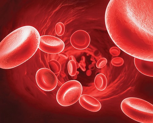 Sự gia tăng đột biến các tế bào bạch cầu trong ung thư máu
