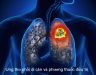 Thuốc chữa ung thư phổi di căn được phát hiện từ nấm lim xanh