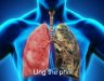 Thuốc ung thư phổi tarceva, những điều cần biết trước khi sử dụng