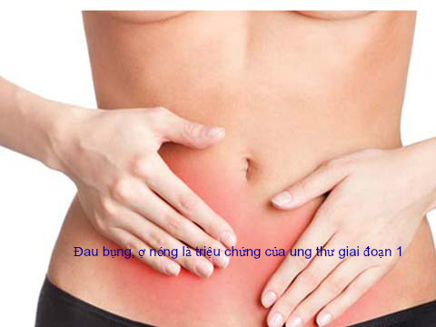 Đau bụng, ợ nóng là triệu chứng của ung thư giai đoạn 1