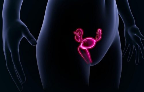 Ung thư buồng trứng di căn có thể xuất hiện từ giai đoạn 3.