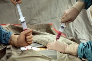 Ghép tế bào gốc ung thư máu là phương pháp được áp dụng nhiều trong điều trị ung thư tại Việt Nam