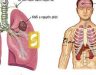 Ung thư phổi di căn vào gan – Phương pháp điều trị ung thư phổi