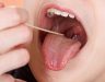 Tìm hiểu về bệnh ung thư vòm họng. Cách điều trị ung thư vòm họng