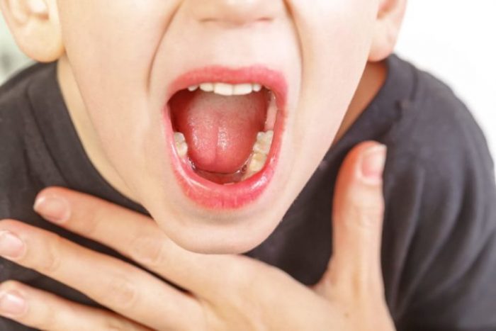 Bệnh ung thư vòm họng phát triển qua 4 giai đoạn