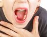 Ung thư vòm họng có sống được bao lâu? Nguyên nhân gây bệnh