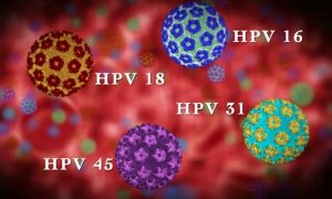 Virus HPV là một trong những nguyên nhân chính gây nên bệnh ung thư cổ tử cung.