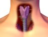 Ung thư vòm họng có chữa được không và sống được bao lâu?
