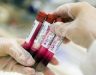 Xét nghiệm máu phát hiện ung thư sớm ở đâu tại Hà Nội uy tín?