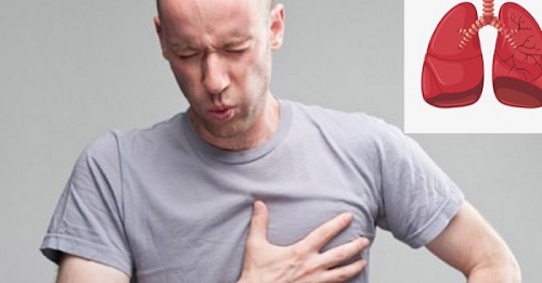 Đau đơn, tức ngực, khó thở triệu chứng K phổi giai đoạn cuối