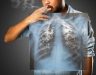 Ung thư phổi có di truyền không theo khẳng định của chuyên gia