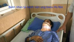 Bệnh nhân tại bệnh viện ung bướu Hà Nội