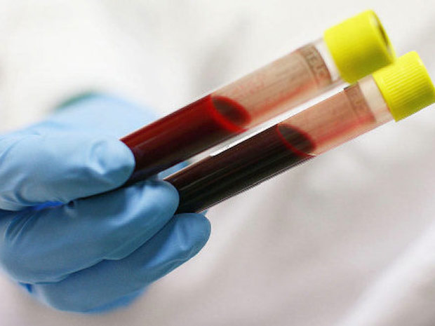 Xét nghiệm máu biết ung thư gan tiến triển như thế nào