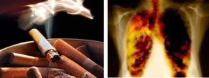 Hút thuốc lá là thói quen gây ung thư phổi của người Việt
