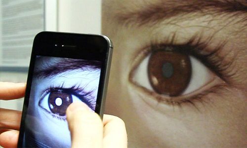 Sử dụng smartphone để phát hiện ung thư mắt