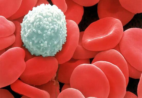 Tế bào ung thư máu ở người